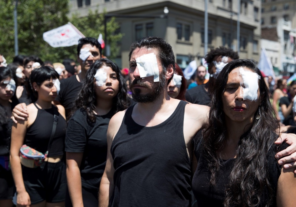 Estudiante pierde la vista tras recibir un disparo durante las protestas en Chile